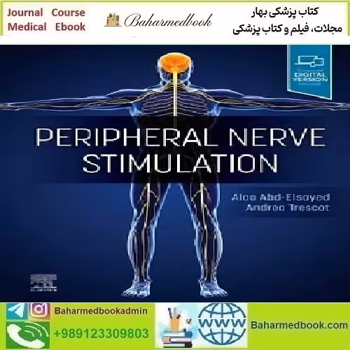 Peripheral Nerve Stimulation A Comprehensive Guide 2023