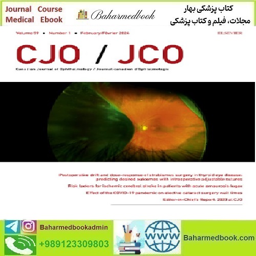 Canadian Journal of Ophthalmology Volume 59 Issue 1 2024