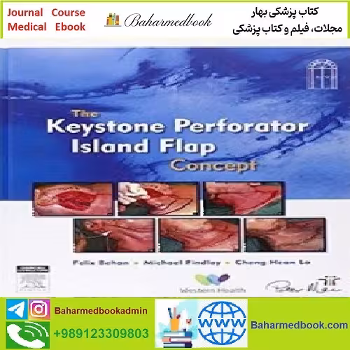The Keystone Perforator Island Flap Concept TRUE PDF price 1€