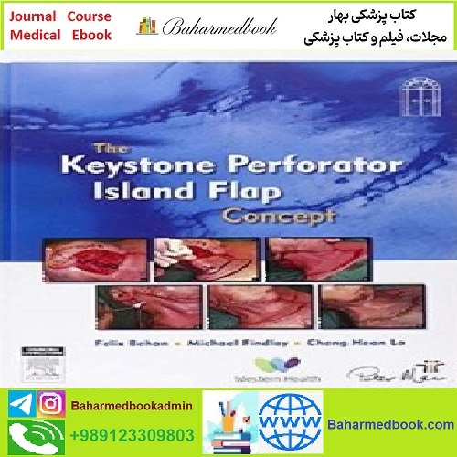 The Keystone Perforator Island Flap Concept TRUE PDF price 1€