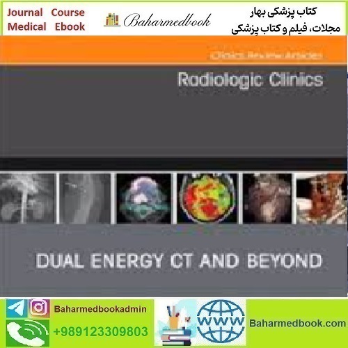 Radiologic Clinics of North America Volume 61 Issue 1 to 6 202