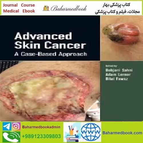 Advanced Skin Cancer A Case Based Approach TRUE PDF pri