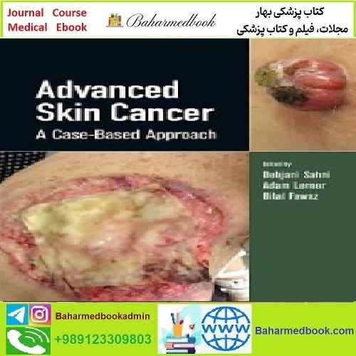 Advanced Skin Cancer A Case Based Approach TRUE PDF pri