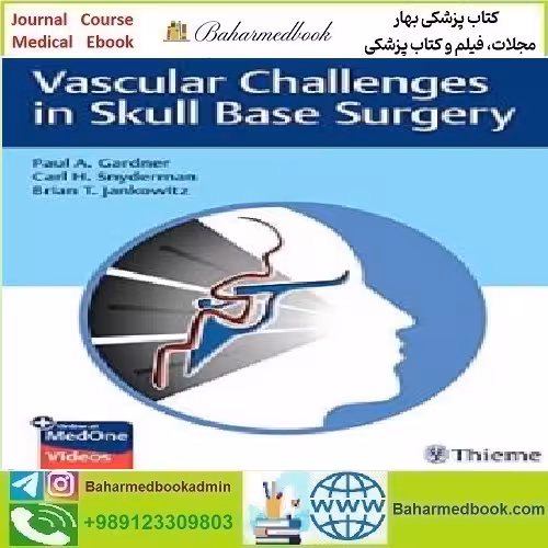 Vascular Challenges in Skull Base Surgery 2022 TRUE PDF pri