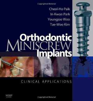 [PDF] دانلود کتاب Orthodontic Miniscrew Implants - Clinical Applications, 2008