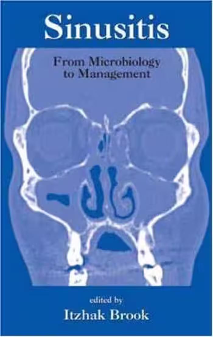 [PDF] دانلود کتاب Sinusitis. From Microbiology To Management, 2005