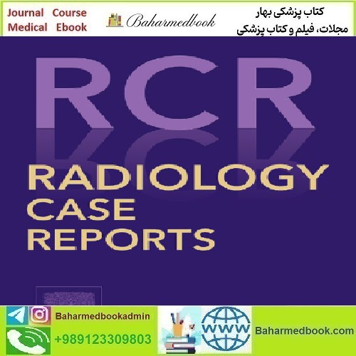 Radiology Case Reports Volume 17 Issue 1