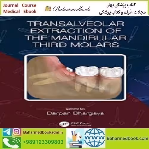 Transalveolar Extraction of the Mandibular Third Molars 2023