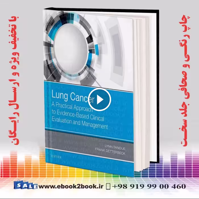 Lung Cancer: A Practical Approach to Evidence-Based Clinical Evaluation and Management