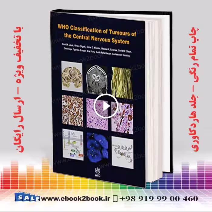 WHO Classification of Tumours of the Central Nervous System 4th Edition