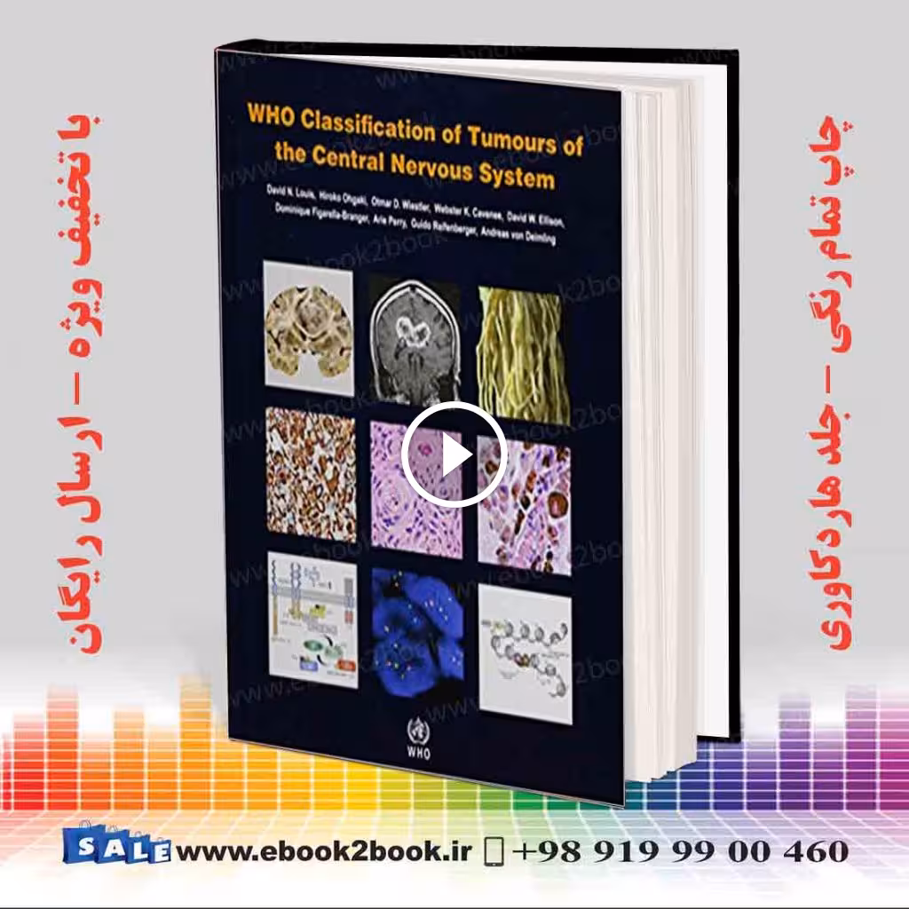 WHO Classification of Tumours of the Central Nervous System 4th Edition