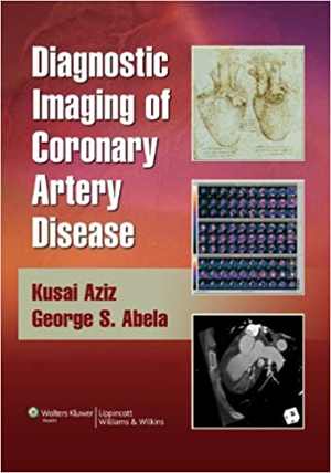 [CHM] دانلود کتاب Diagnostic Imaging Of Coronary Artery Disease, 2009