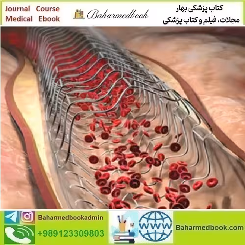 Comprehensive Review of Interventional Cardiology 2023 video