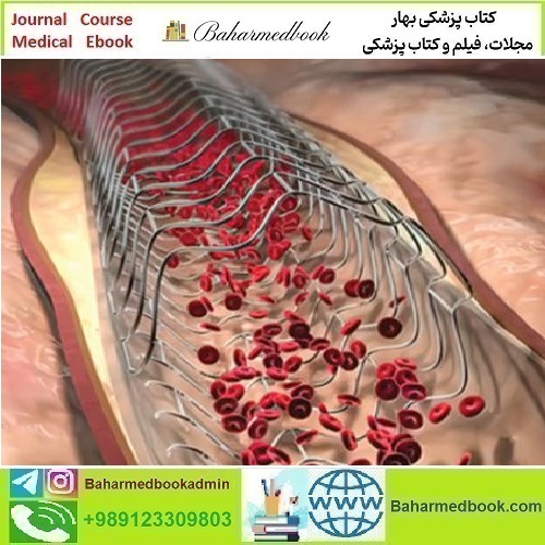 Comprehensive Review of Interventional Cardiology 2023 video