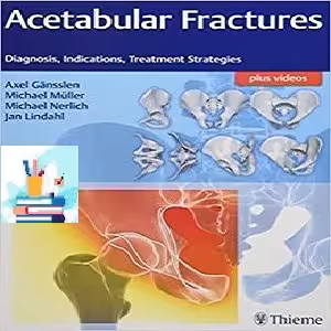 Acetabular Fractures Diagnosis Indications Treatment Strategies 1ed PDF Video at 1€ - کتاب پزشکی بهار