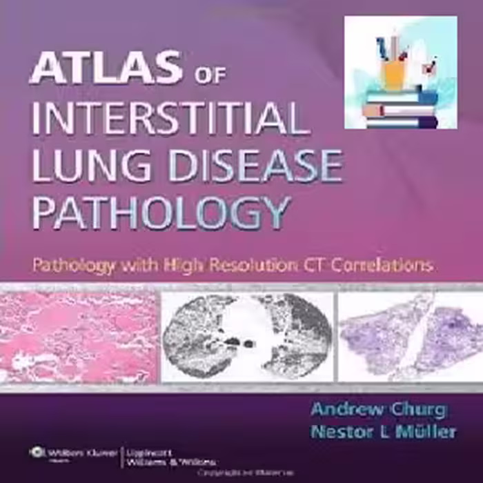 Atlas of Interstitial Lung Disease Pathology TRUE PDF price 1€