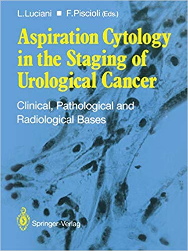󾕇 دانلود کتاب Aspiration Cytology In The Staging Of Urological Cancer - Clinical, Pathological And Radiological Bases, 1988 - دانلود کتاب های دانشگاهی