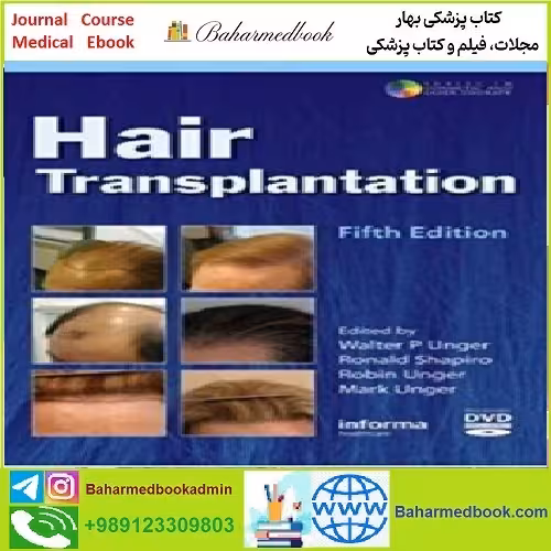 Hair Transplantation TRUE PDF price 1€ - کتاب پزشکی بهار