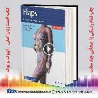 Flaps : Practical Reconstructive Surgery
