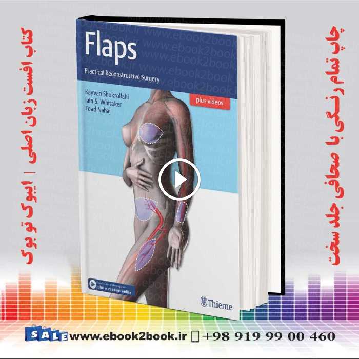 Flaps : Practical Reconstructive Surgery