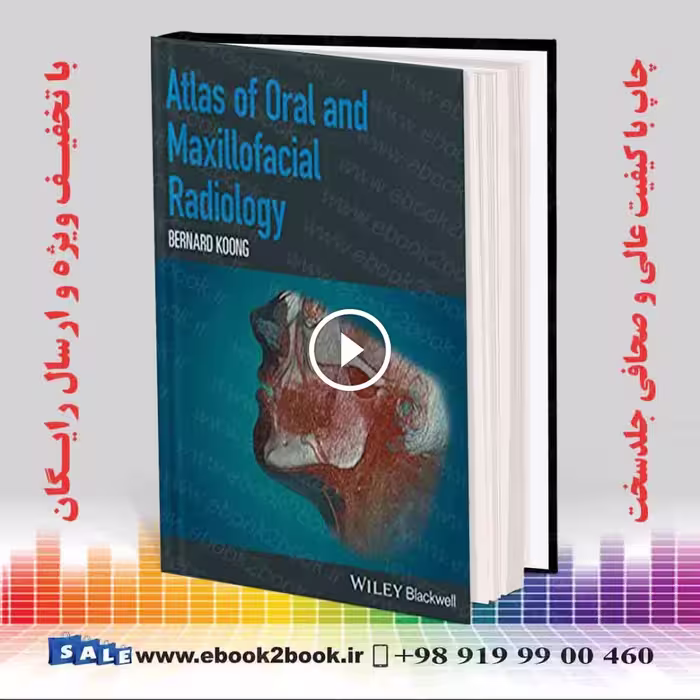 Atlas of Oral and Maxillofacial Radiology