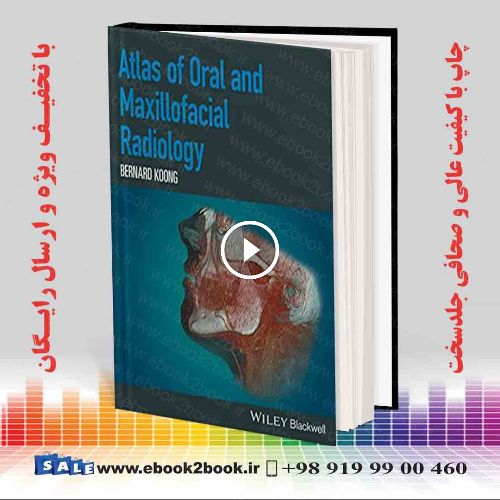 Atlas of Oral and Maxillofacial Radiology