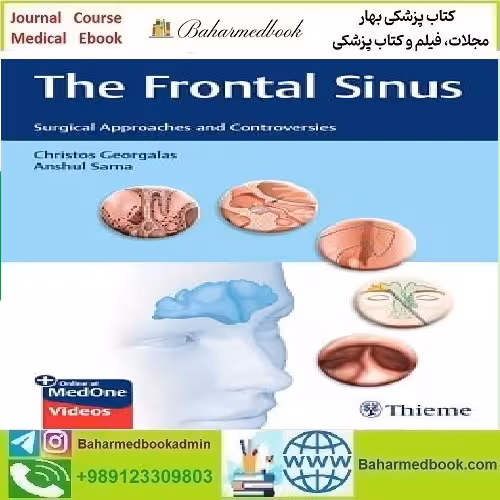 The Frontal Sinus Surgical Approaches and Controversies Video