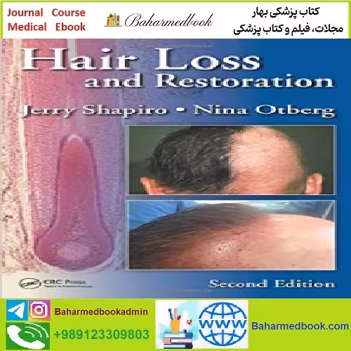 Hair Loss and Restoration TRUE PDF price 1€ - کتاب پزشکی بهار