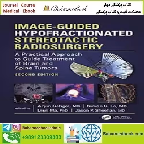 Image Guided Hypofractionated Stereotactic Radiosurgery