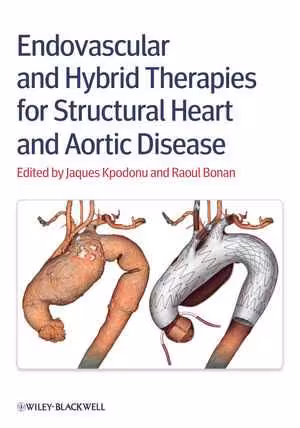 [PDF] دانلود کتاب Endovascular And Hybrid Therapies For Structural Heart And Aortic Disease, 2013
