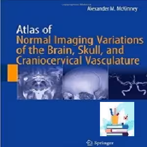 Atlas of Normal Imaging Variations of the Brain Skull and Cranioce
