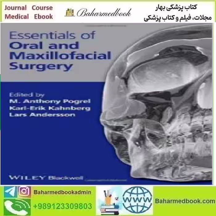 Essentials of Oral and Maxillofacial Surgery 2014