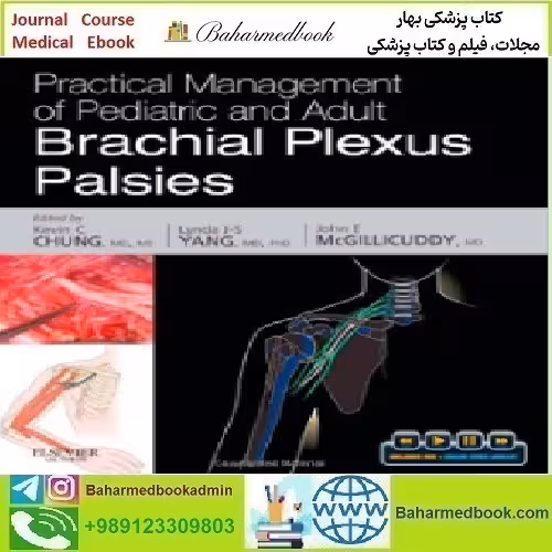 Practical Management of Pediatric and Adult Brachial Plexus Pals