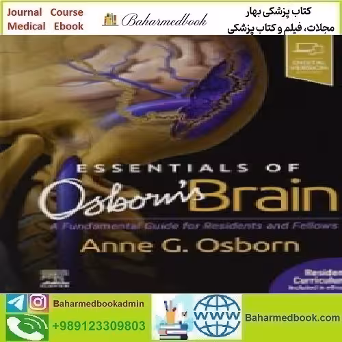 Essentials of Osborn's Brain A Fundamental Guide for Residents a