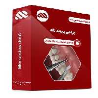 ویدئوی جراحی پیوند لثه