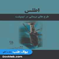 اطلس طرح های درمانی در ایمپلنت