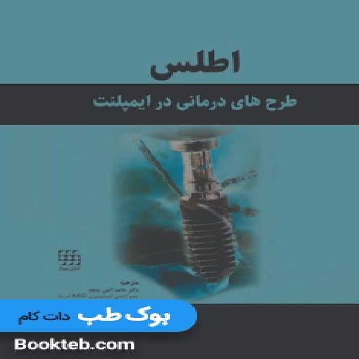 اطلس طرح های درمانی در ایمپلنت