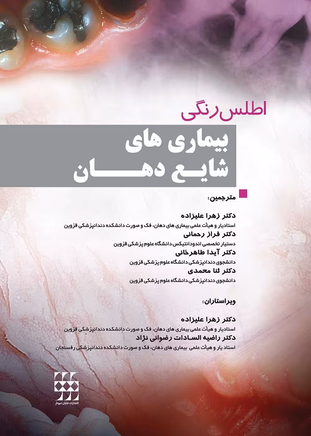 اطلس رنگی بیماری های شایع دهان