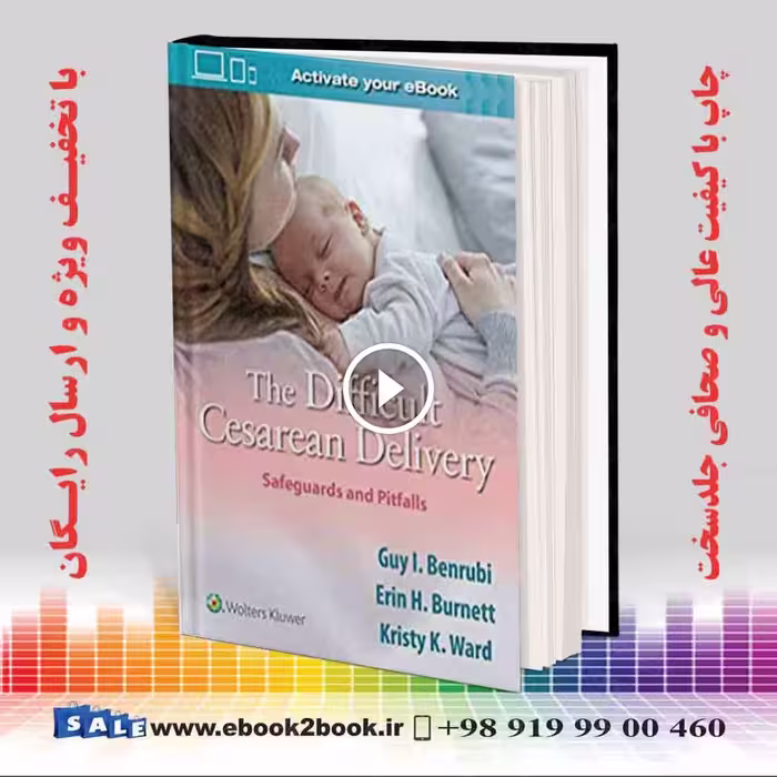 The Difficult Cesarean Delivery: Safeguards and Pitfalls