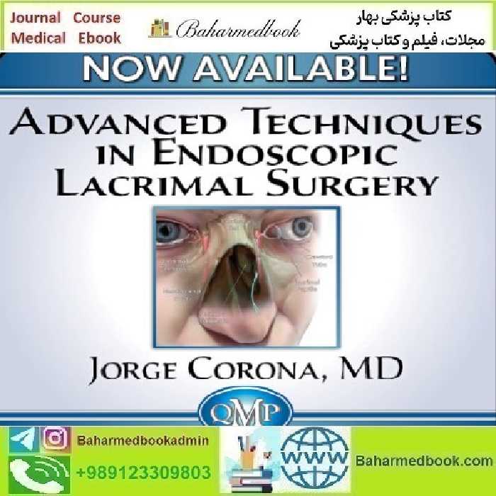 Advanced Techniques in Endoscopic Lacrimal Surgery 2023 vide