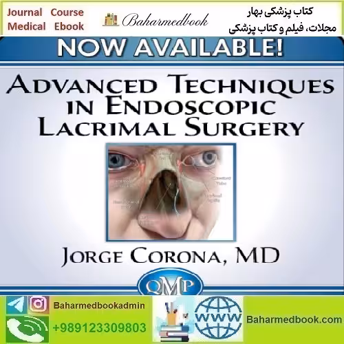 Advanced Techniques in Endoscopic Lacrimal Surgery 2023 vide