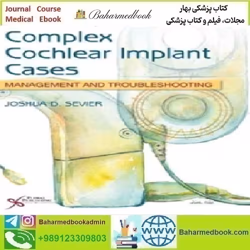 Complex Cochlear Implant Cases Management and Troublesho