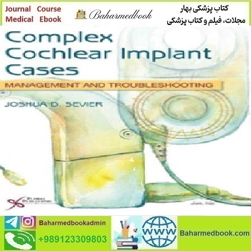 Complex Cochlear Implant Cases Management and Troublesho