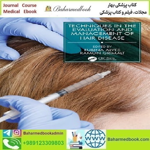 Techniques in the Evaluation and Management of Hair Diseases