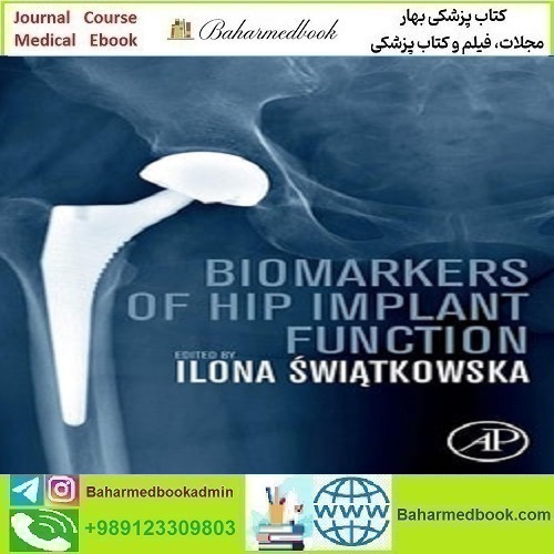 Biomarkers of Hip Implant Function 2023 دانلود کتاب الکترونیکی