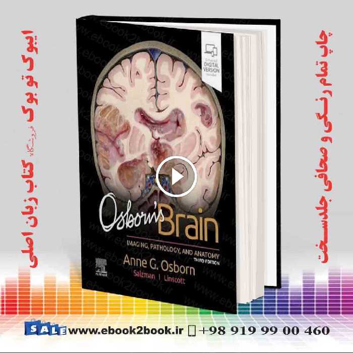 Osborn’s Brain 3rd Edition