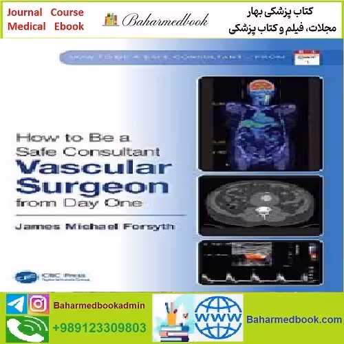 How to be a Safe Consultant Vascular Surgeon from Day