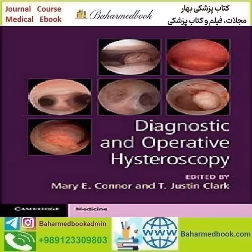 Diagnostic and Operative Hysteroscopy 2020 TRUE PDF price 1€ - کتاب پزشکی بهار