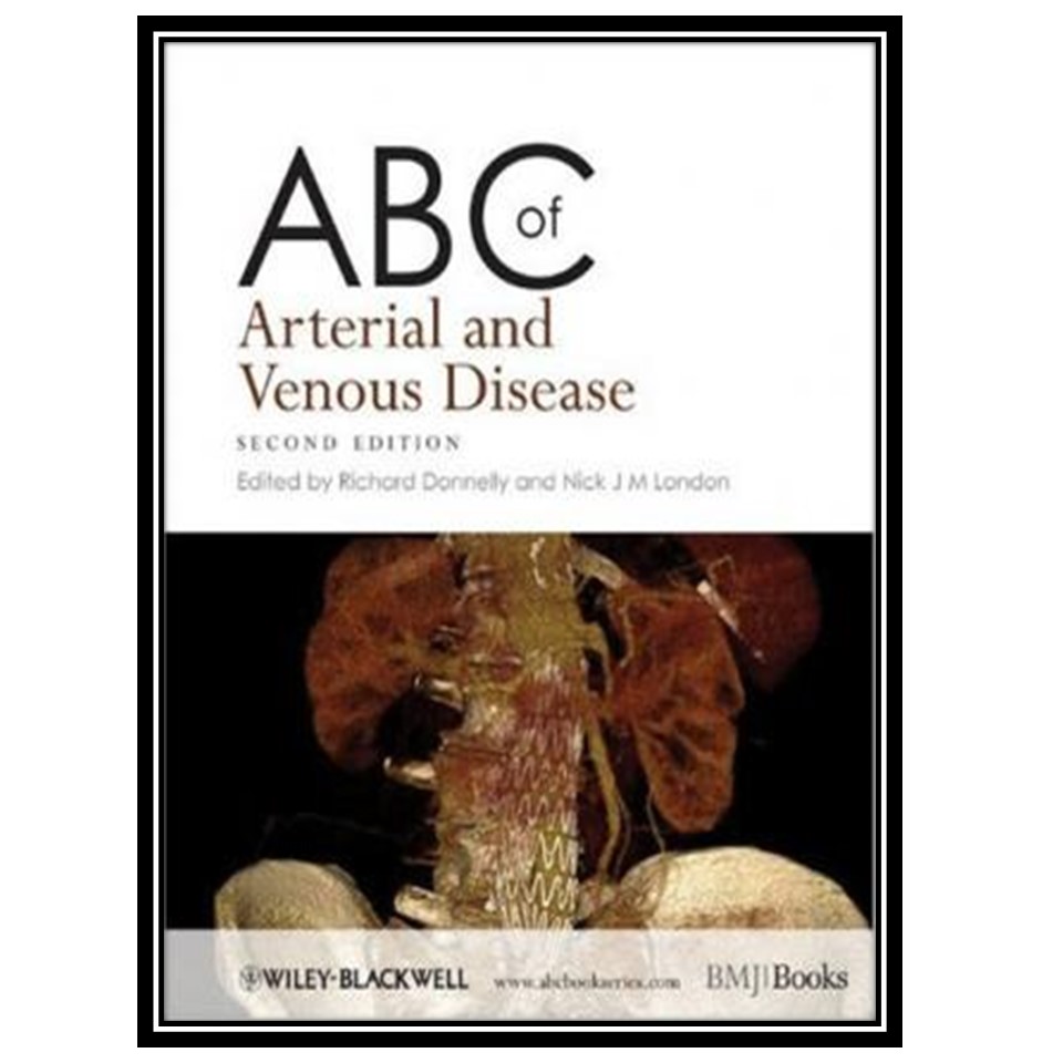 کتاب ABC of Arterial and Venous Disease اثر Richard Donnelly and Nick J M London انتشارات مؤلفین طلایی