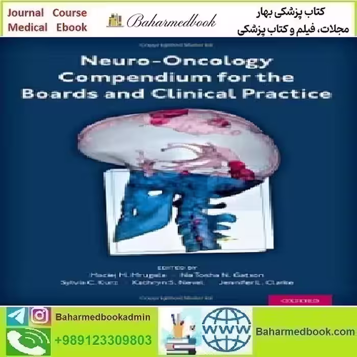 Neuro Oncology Compendium for the Boards and Clinical Practi